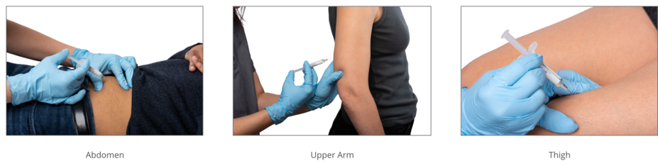 LEQVIO (inclisiran) injection can be administered in the abdomen, upper arm, or thigh